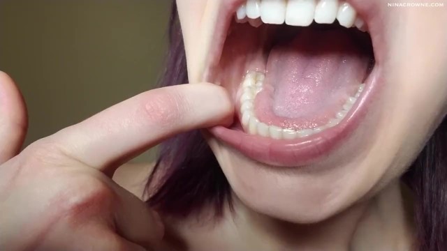 Dental Mouth Exploration Preview